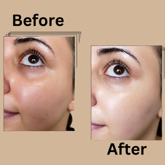 Rice Serum