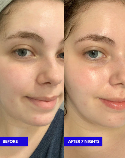 Glow Rest-Night Cream